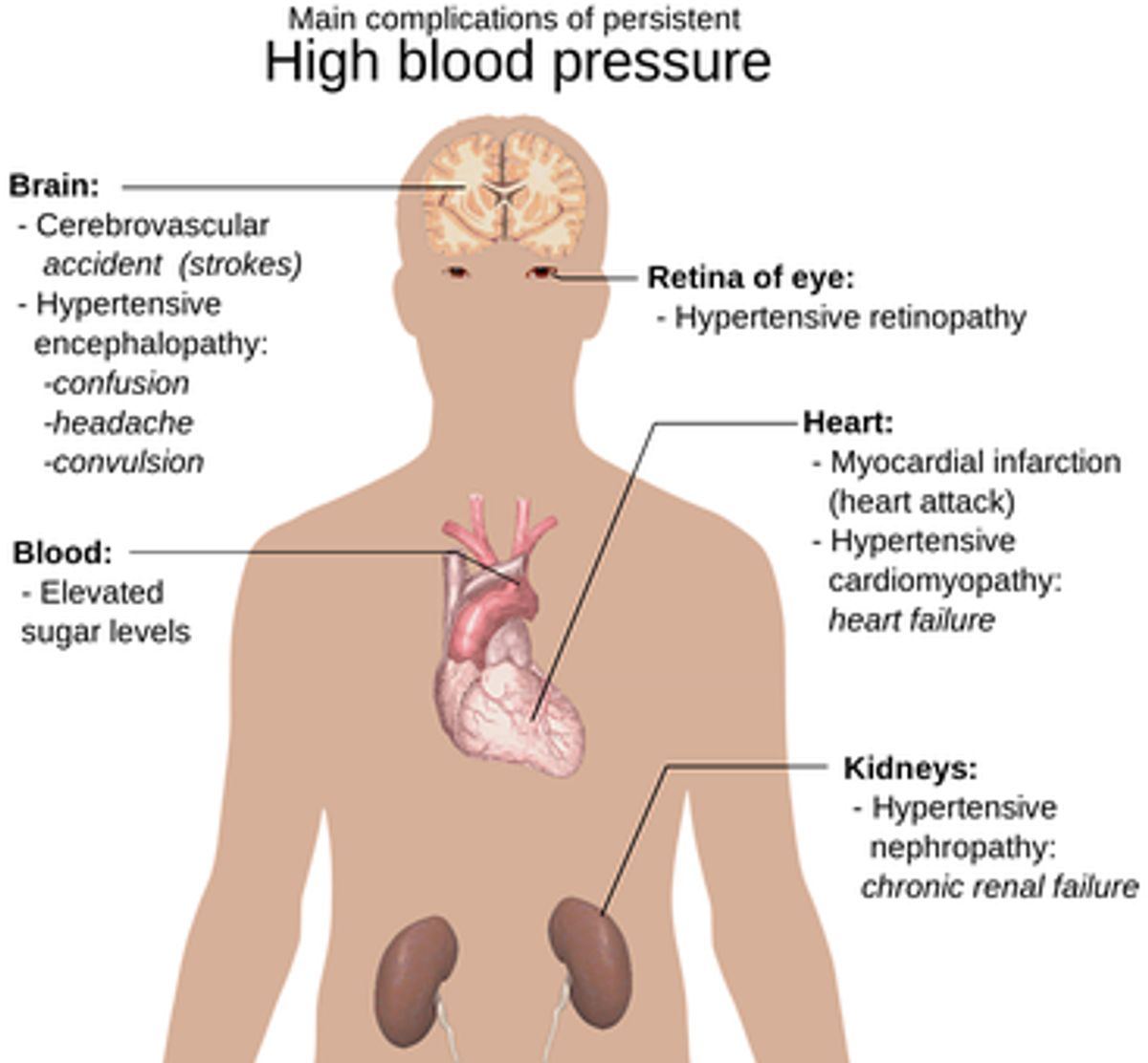 Symptoms Of High Blood Pressure