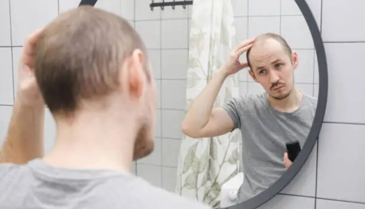 HAIR TRANSPLANT IN ARIZONA
