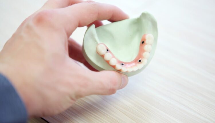 Dental Implants in New York