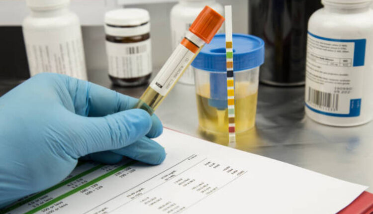 pH probes 