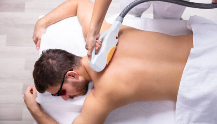 Laser Hair Removal