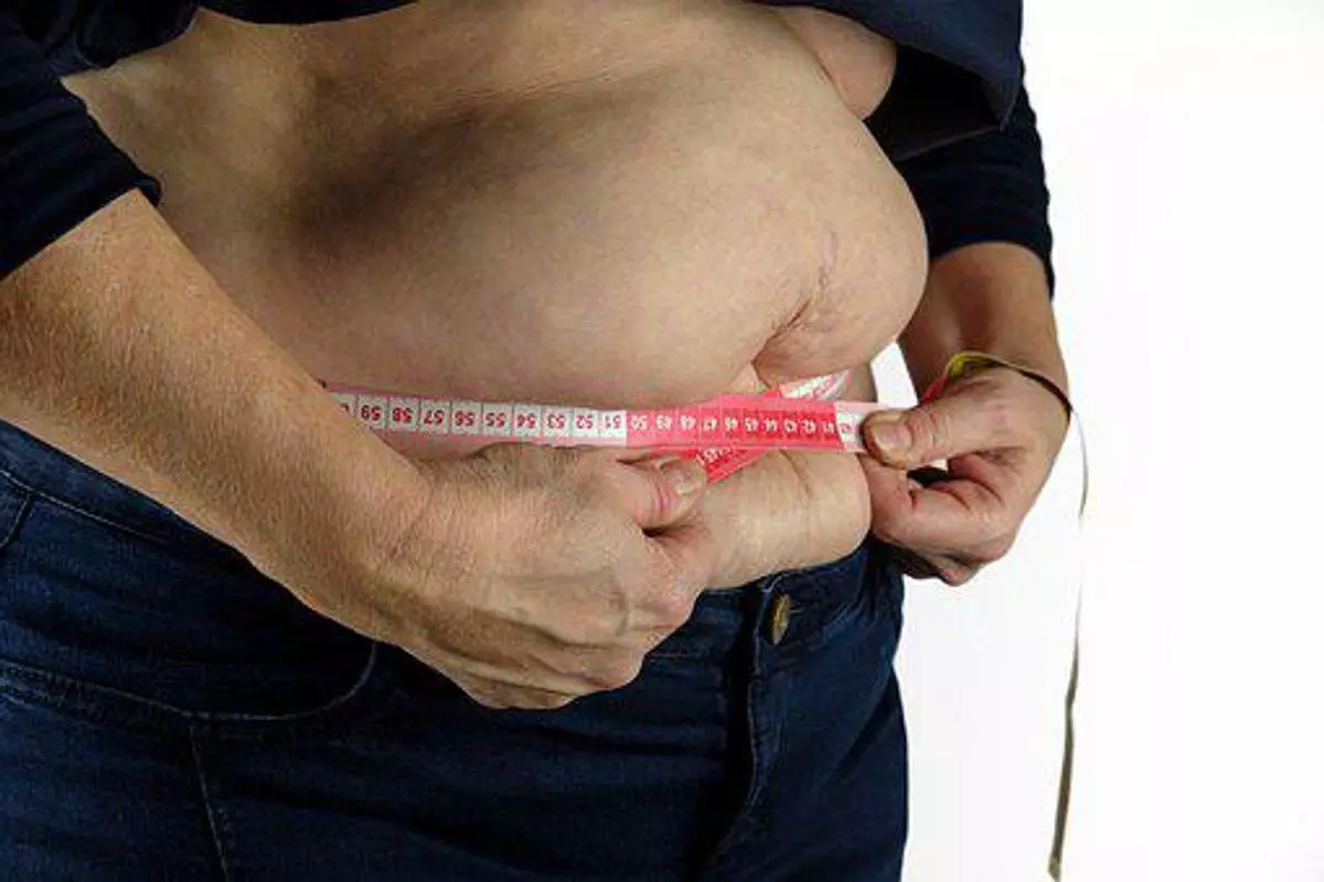 Obesity In America