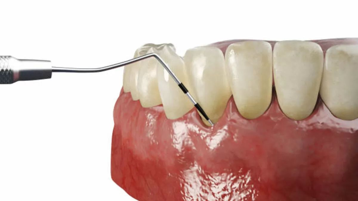 gum disease