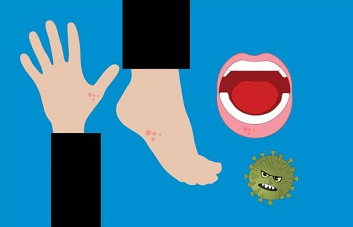 hand foot mouth disease