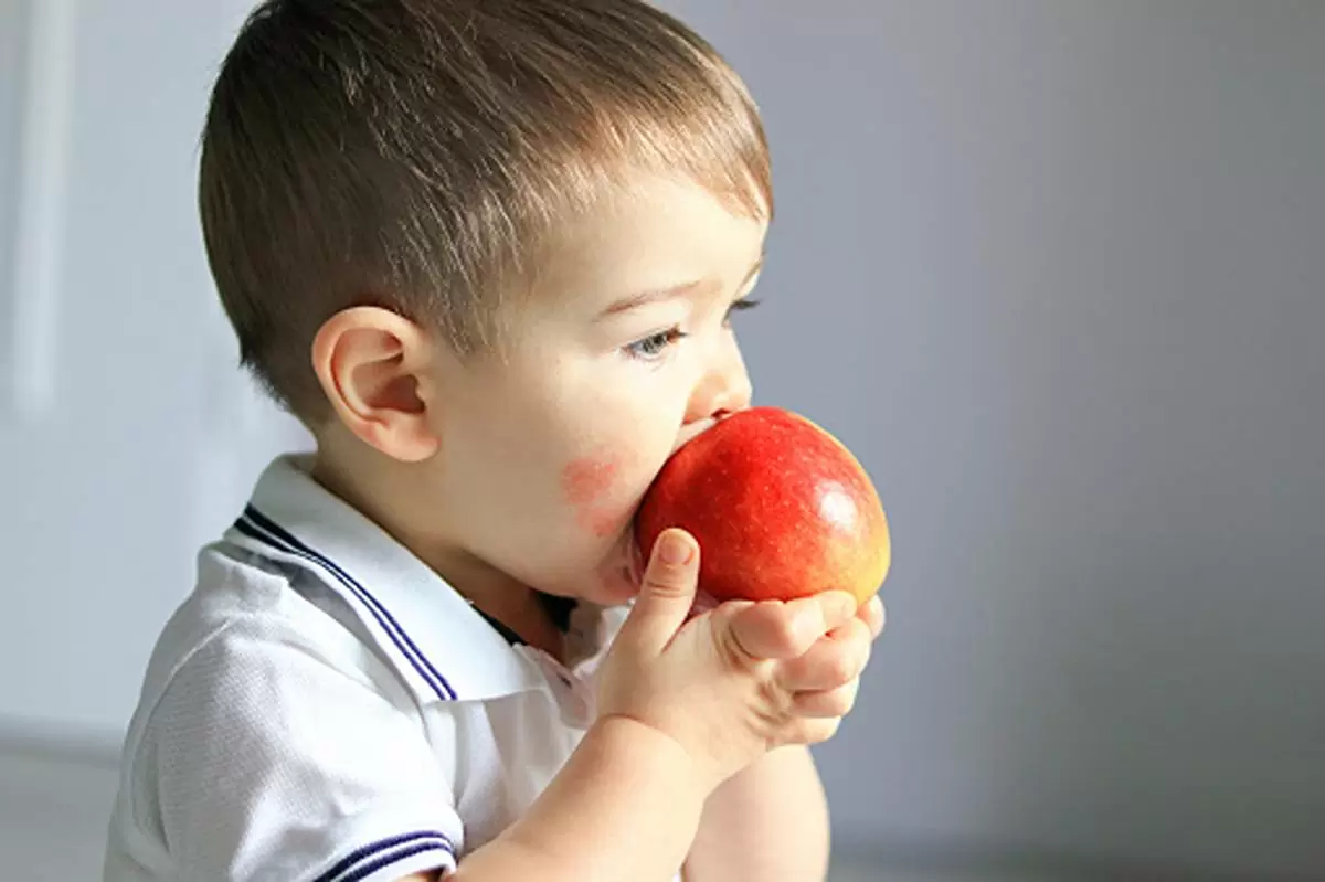 Food Allergies in Babies