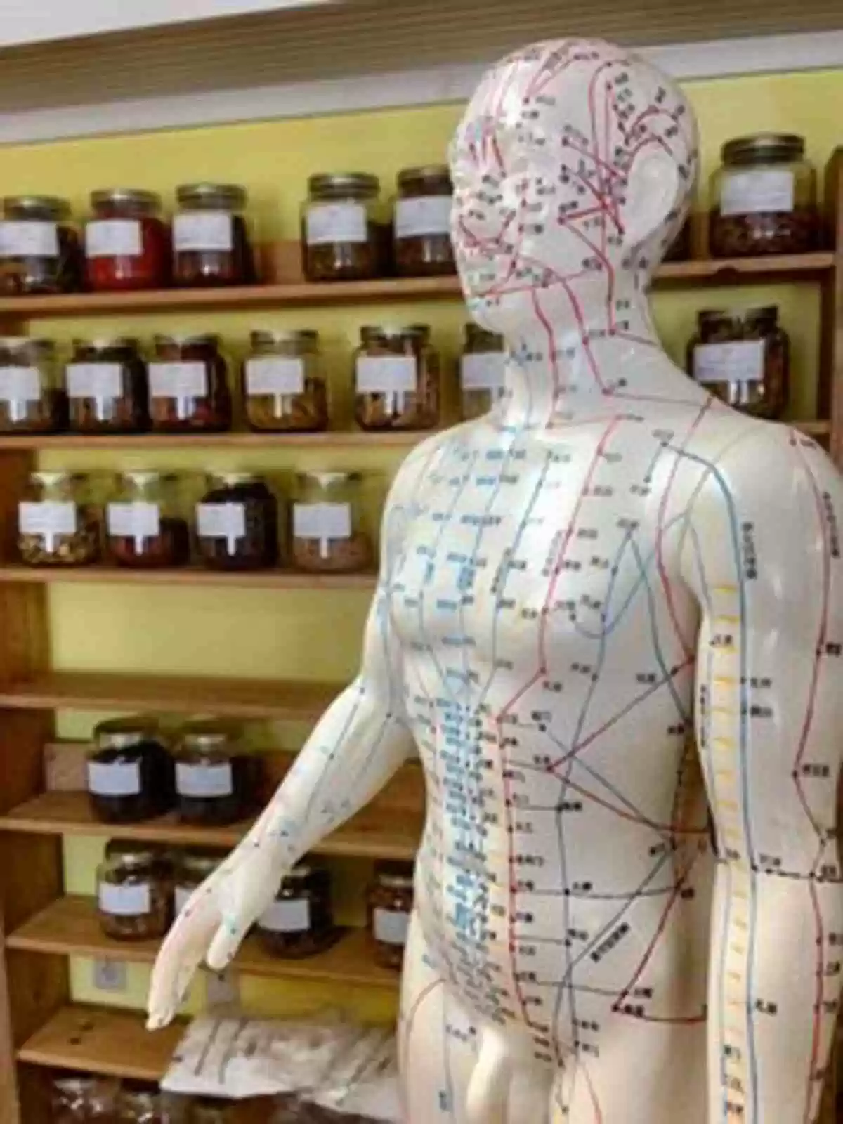 Pain-Free Acupuncture – Acupuncture With regard to Anxiety