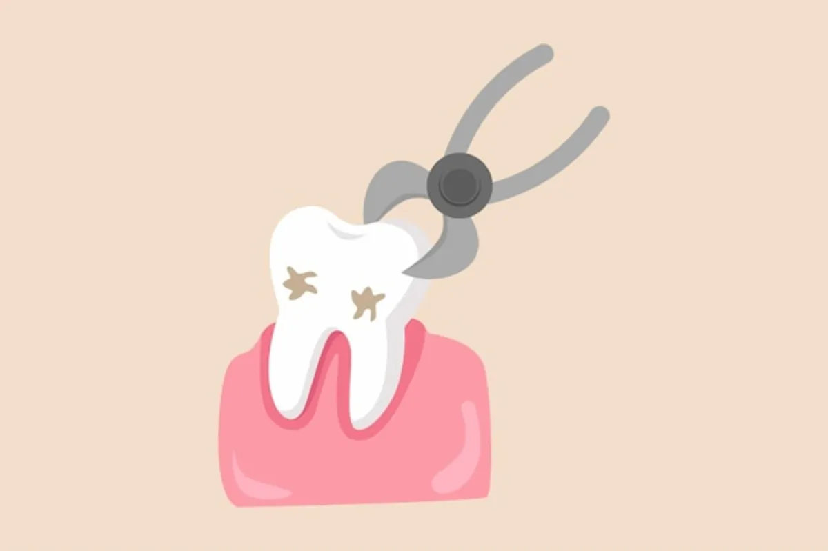 dental problems