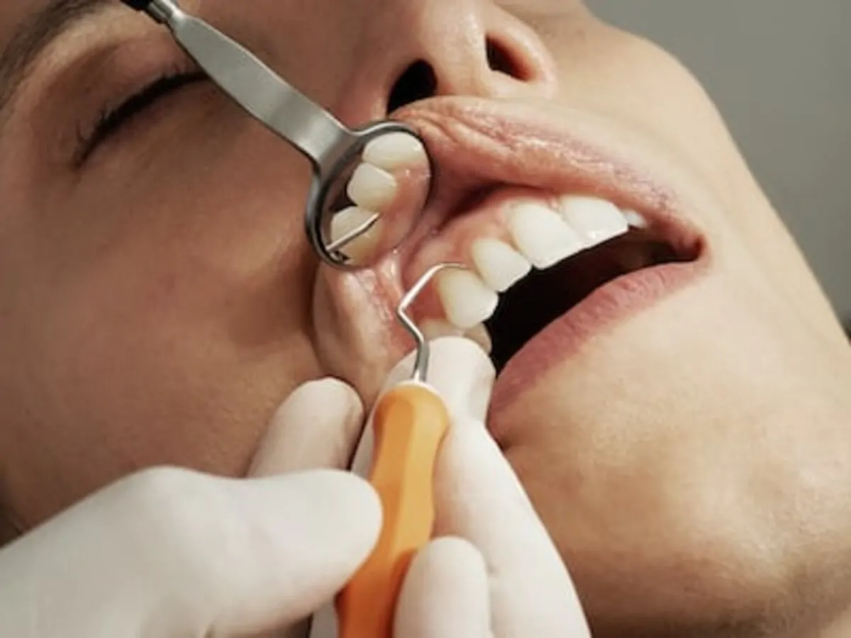 Dental implants in Milwaukee