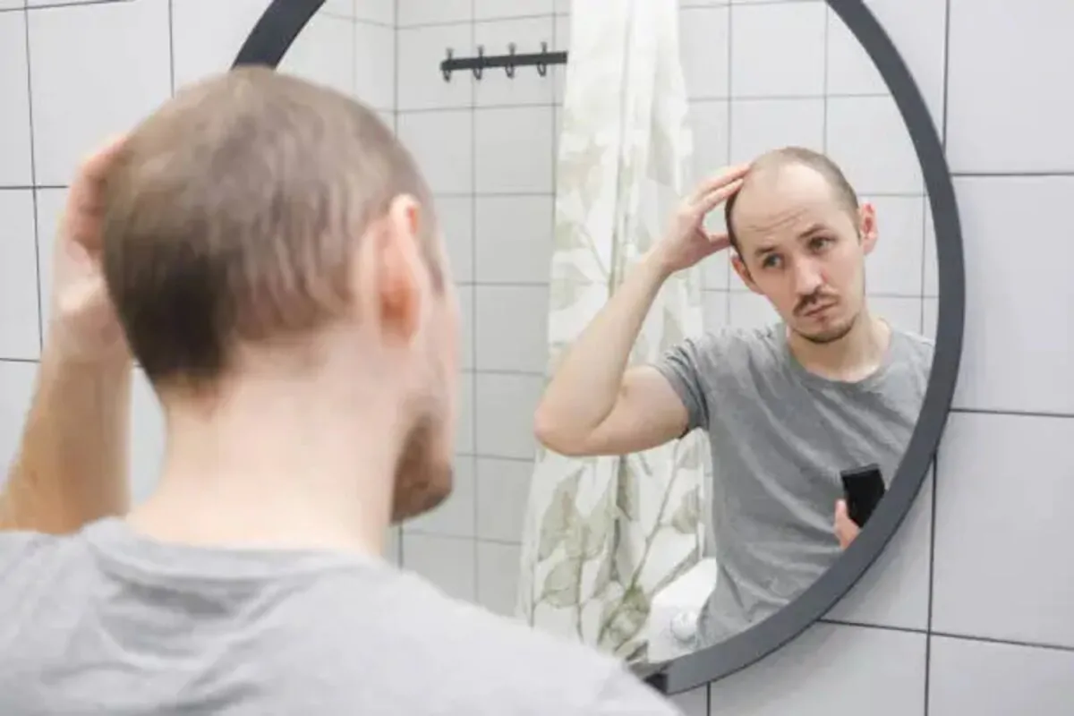 How to Cope With Post Hair Transplant Pain