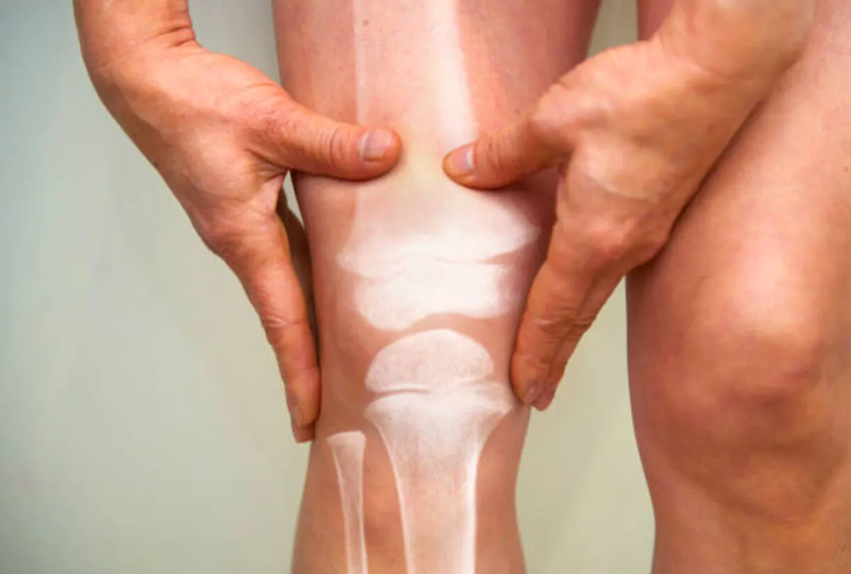 physio for knee pain