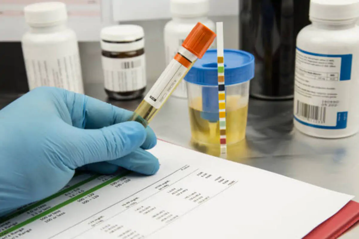 pH probes 